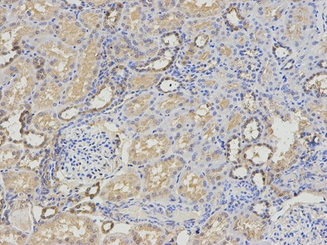 RRM2 Antibody - Immunohistochemistry of paraffin-embedded human kidney using RRM2 antibody at dilution of 1:200 (200x lens).