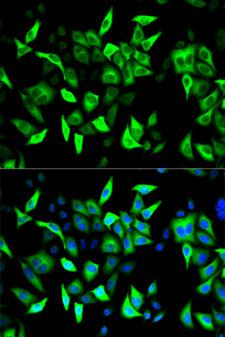 RRM2 Antibody - Immunofluorescence analysis of HeLa cell using RRM2 antibody. Blue: DAPI for nuclear staining