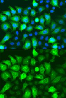 RRM2 Antibody - Immunofluorescence analysis of A549 cells.