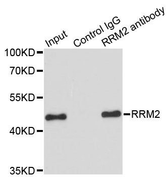 RRM2 Antibody - Immunoprecipitation analysis of 200ug extracts of HeLa cells.