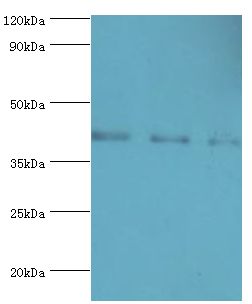 RRM2B / P53R2 Antibody - Western blot. All lanes: E3 Ribonucleoside-diphosphate reductase subunit M2 B antibody at 3 ug/ml. Lane 1: MCF-7 whole cell lysate. Lane 2: HeLa whole cell lysate. Lane 3: HepG2 whole cell lysate. secondary Goat polyclonal to rabbit at 1:10000 dilution. Predicted band size: 41 kDa. Observed band size: 41 kDa.