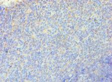 RRM2B / P53R2 Antibody - Immunohistochemistry of paraffin-embedded human tonsil using antibody at 1:100 dilution.