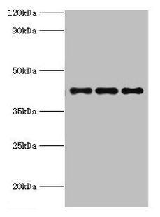 RRM2B / P53R2 Antibody - Western blot All lanes: RRM2B antibody at 3µg/ml Lane 1: MCF-7 whole cell lysate Lane 2: Hela whole cell lysate Lane 3: HepG2 whole cell lysate Secondary Goat polyclonal to rabbit IgG at 1/10000 dilution Predicted band size: 41, 35, 16, 8, 5, 49 kDa Observed band size: 41 kDa
