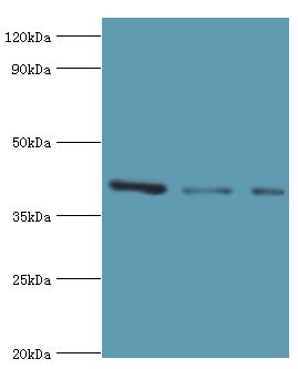 RRM2B / P53R2 Antibody - Western blot. All lanes: E3 Ribonucleoside-diphosphate reductase subunit M2 B antibody at 6 ug/ml. Lane 1: MCF-7 whole cell lysate. Lane 2: HeLa whole cell lysate. Lane 3: HepG2 whole cell lysate. secondary Goat polyclonal to rabbit at 1:10000 dilution. Predicted band size: 41 kDa. Observed band size: 41 kDa.