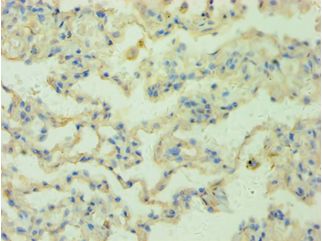 RRM2B / P53R2 Antibody - Immunohistochemistry of paraffin-embedded human lung using antibody at 1:100 dilution.