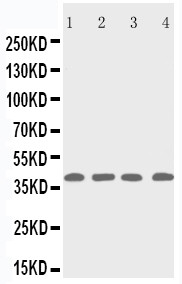 RRM2B / P53R2 Antibody - WB of RRM2B antibody. Lane 1: Rat Thymus Tissue Lysate. Lane 2: MCF-7 Cell Lysate. Lane 3: A431 Cell Lysate. Lane 4: HELA Cell Lysate..