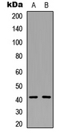 RRM2B / P53R2 Antibody - Western blot analysis of RRM2B expression in HepG2 (A); MCF7 (B) whole cell lysates.