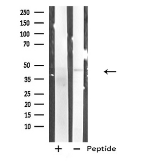 RRM2B / P53R2 Antibody - Western blot analysis of extracts of COLO205 cells using RRM2B antibody.