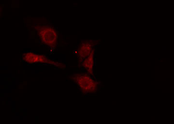 RRM2B / P53R2 Antibody - Staining COLO205 cells by IF/ICC. The samples were fixed with PFA and permeabilized in 0.1% Triton X-100, then blocked in 10% serum for 45 min at 25°C. The primary antibody was diluted at 1:200 and incubated with the sample for 1 hour at 37°C. An Alexa Fluor 594 conjugated goat anti-rabbit IgG (H+L) antibody, diluted at 1/600, was used as secondary antibody.