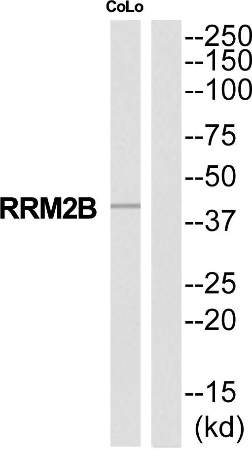 RRM2B / P53R2 Antibody - Western blot analysis of extracts from COLO205 cells, using RRM2B antibody.