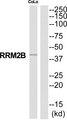 RRM2B / P53R2 Antibody - Western blot analysis of extracts from COLO205 cells, using RRM2B antibody.