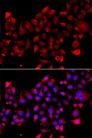 RRM2B / P53R2 Antibody - Immunofluorescence analysis of A549 cells using RRM2B Polyclonal Antibody.