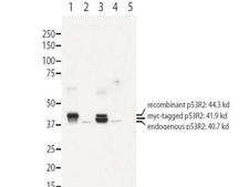 RRM2B / P53R2 Antibody - Anti-RRM2B antibody - Western Blot. Western blot of affinity purified anti-RRM2B antibody shows detection of recombinant (lanes 1 and 3) and endogenous protein (lanes 1 to 4) in whole cell extracts from transfected 293T. Lane 1 contains purified recombinant human p53R2. Lane 2 contains 293T cells transfected with control vector. Lane 3 contains 293T transfected with p53R2-myc. Lane 4:293T transfected with ScRNA. Lane 5:293T transfected with p53R2 SiRNA The band at 40.7 kD, indicated by the bottom arrowhead, corresponds to the expected molecular weight of endogenous RRM2B. The band with the middle arrow corresponds to myc-tagged p53R2 at 41.9kD. The highest band at 44.3 kD corresponds to recombinant p53R2. Primary antibody was diluted to 1 ug/mL and incubated overnight at 4C. ECL detection was used.