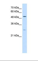 RRP1 Antibody - HepG2 cell lysate. Antibody concentration: 0.5 ug/ml. Gel concentration: 12%.  This image was taken for the unconjugated form of this product. Other forms have not been tested.