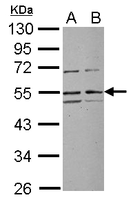 RRP1 Antibody - Sample (30 ug of whole cell lysate) A: Jurkat B: Raji 10% SDS PAGE RRP1 antibody diluted at 1:1000