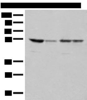 RRP1 Antibody - Western blot analysis of 293T and Jurkat cell lysates  using RRP1 Polyclonal Antibody at dilution of 1:400