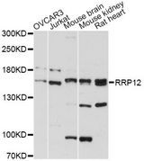 RRP12 Antibody - Western blot analysis of extracts of various cell lines, using RRP12 antibody at 1:3000 dilution. The secondary antibody used was an HRP Goat Anti-Rabbit IgG (H+L) at 1:10000 dilution. Lysates were loaded 25ug per lane and 3% nonfat dry milk in TBST was used for blocking. An ECL Kit was used for detection and the exposure time was 90s.