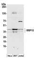 RRP15 Antibody - Detection of human RRP15 by western blot. Samples: Whole cell lysate (50 µg) from HeLa, HEK293T, and Jurkat cells prepared using NETN lysis buffer. Antibody: Affinity purified rabbit anti-RRP15 antibody used for WB at 1:1000. Detection: Chemiluminescence with an exposure time of 30 seconds.