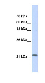 RRP22 / RASL10A Antibody - RASL10A antibody Western blot of Transfected 293T cell lysate. This image was taken for the unconjugated form of this product. Other forms have not been tested.