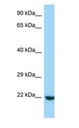 RRP22 / RASL10A Antibody - RRP22 / RASL10A antibody Western Blot of Mouse Lung.  This image was taken for the unconjugated form of this product. Other forms have not been tested.