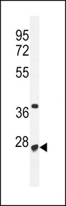 RRP36 Antibody - CF153 Antibody western blot of mouse Neuro-2a cell line lysates (35 ug/lane). The CF153 antibody detected the CF153 protein (arrow).
