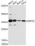 RRP36 Antibody - Western blot analysis of extracts of various cell lines, using RRP36 antibody at 1:3000 dilution. The secondary antibody used was an HRP Goat Anti-Rabbit IgG (H+L) at 1:10000 dilution. Lysates were loaded 25ug per lane and 3% nonfat dry milk in TBST was used for blocking. An ECL Kit was used for detection and the exposure time was 90s.