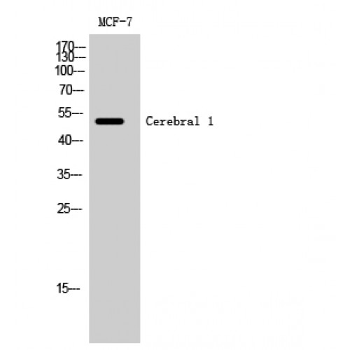 RRP8 Antibody - Western blot of Cerebral 1 antibody