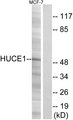 RRP8 Antibody - Western blot analysis of lysates from MCF-7 cells, using HUCE1 Antibody. The lane on the right is blocked with the synthesized peptide.