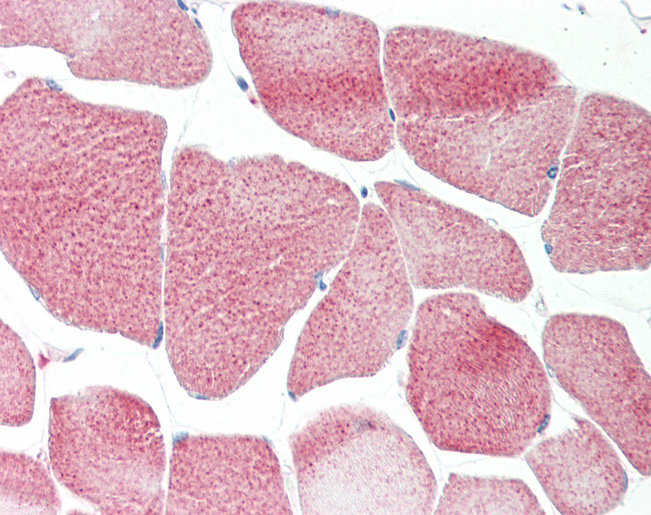 RRP8 Antibody - Human Skeletal Muscle: Formalin-Fixed, Paraffin-Embedded (FFPE).  This image was taken for the unconjugated form of this product. Other forms have not been tested.
