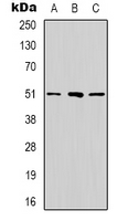 RRP8 Antibody - Western blot analysis of RRP8 expression in HeLa (A); MCF7 (B); HeLa (C) whole cell lysates.
