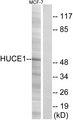RRP8 Antibody - Western blot analysis of extracts from MCF-7 cells, using HUCE1 antibody.