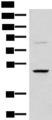 RRP8 Antibody - Western blot analysis of Human bladder transitional cell carcinoma grade 2-3 tissue lysate  using RRP8 Polyclonal Antibody at dilution of 1:800