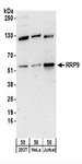 RRP9 Antibody - Detection of Human RRP9 by Western Blot. Samples: Whole cell lysate (50 ug) from 293T, HeLa, and Jurkat cells. Antibodies: Affinity purified rabbit anti-RRP9 antibody used for WB at 0.4 ug/ml. Detection: Chemiluminescence with an exposure time of 3 minutes.