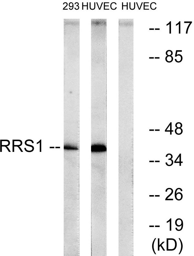 RRS1 Antibody - Western blot analysis of lysates from HUVEC and 293 cells, using RRS1 Antibody. The lane on the right is blocked with the synthesized peptide.