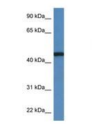 RRS1 Antibody - RRS1 antibody Western blot of MCF7 Cell lysate. Antibody concentration 1 ug/ml.  This image was taken for the unconjugated form of this product. Other forms have not been tested.