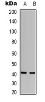 RRS1 Antibody - Western blot analysis of RRS1 expression in HeLa (A); SHSY5Y (B) whole cell lysates.
