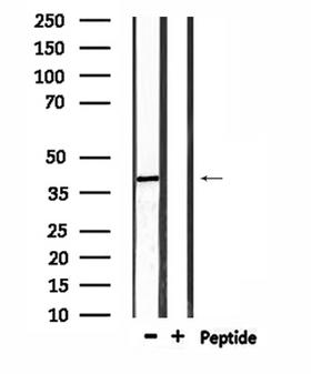 RRS1 Antibody - Western blot analysis of extracts of HepG2 cells using RRS1 antibody.