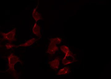 RRS1 Antibody - Staining HuvEc cells by IF/ICC. The samples were fixed with PFA and permeabilized in 0.1% Triton X-100, then blocked in 10% serum for 45 min at 25°C. The primary antibody was diluted at 1:200 and incubated with the sample for 1 hour at 37°C. An Alexa Fluor 594 conjugated goat anti-rabbit IgG (H+L) Ab, diluted at 1/600, was used as the secondary antibody.