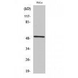 RSAD1 Antibody - Western blot of RSAD1 antibody