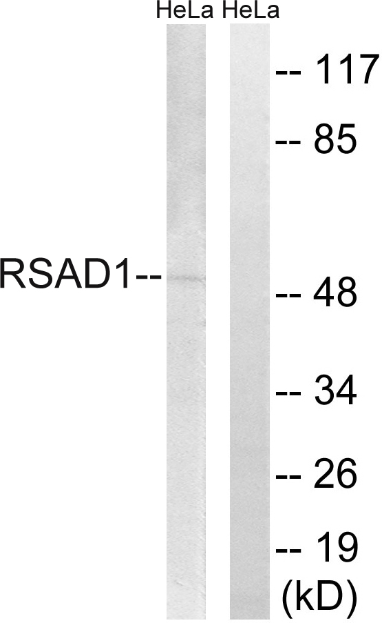 RSAD1 Antibody - Western blot analysis of lysates from HeLa cells, using RSAD1 Antibody. The lane on the right is blocked with the synthesized peptide.