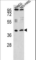 RSAD1 Antibody - Western blot of RSAD1 Antibody in HepG2,NCI-H460 cell line lysates (35 ug/lane). RSAD1 (arrow) was detected using the purified antibody.
