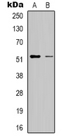 RSAD1 Antibody - Western blot analysis of RSAD1 expression in HepG2 (A); HeLa (B) whole cell lysates.