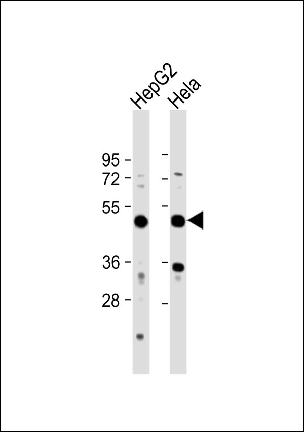 RSAD1 Antibody - All lanes: Anti-RSAD1 Antibody at 1:1000 dilution. Lane 1: HepG2 whole cell lysate. Lane 2: HeLa whole cell lysate Lysates/proteins at 20 ug per lane. Secondary Goat Anti-Rabbit IgG, (H+L), Peroxidase conjugated at 1:10000 dilution. Predicted band size: 49 kDa. Blocking/Dilution buffer: 5% NFDM/TBST.