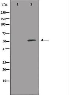 RSAD1 Antibody - Western blot analysis of extracts of HeLa cells using RSAD1 antibody. The lane on the left is treated with the antigen-specific peptide.