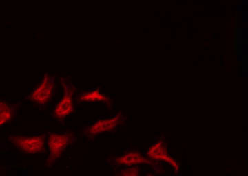 RSAD1 Antibody - Staining HeLa cells by IF/ICC. The samples were fixed with PFA and permeabilized in 0.1% Triton X-100, then blocked in 10% serum for 45 min at 25°C. The primary antibody was diluted at 1:200 and incubated with the sample for 1 hour at 37°C. An Alexa Fluor 594 conjugated goat anti-rabbit IgG (H+L) Ab, diluted at 1/600, was used as the secondary antibody.