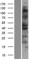 RSAD1 Protein - Western validation with an anti-DDK antibody * L: Control HEK293 lysate R: Over-expression lysate