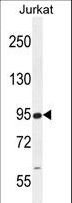 RSBN1 Antibody - RSBN1 Antibody western blot of Jurkat cell line lysates (35 ug/lane). The RSBN1 antibody detected the RSBN1 protein (arrow).