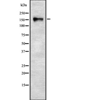 RSF1 / RSF-1 Antibody - Western blot analysis of RSF1 using Jurkat whole cells lysates