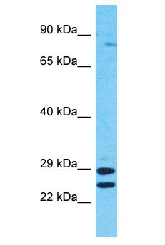 RSHL1 Antibody - RSHL1 antibody Western Blot of HepG2. Antibody dilution: 1 ug/ml.  This image was taken for the unconjugated form of this product. Other forms have not been tested.