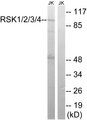 RSK1+2+3+4 Antibody - Western blot analysis of lysates from Jurkat cells, using RSK1/2/3/4 Antibody. The lane on the right is blocked with the synthesized peptide.